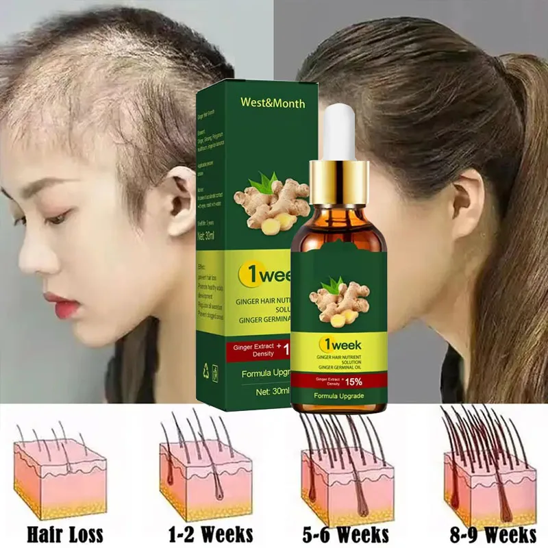 Licorice Root Sticks - 7-dniowe imbirowe produkty na porost włosów